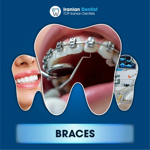 Iranian Braces Clinic and Dentist in Australia