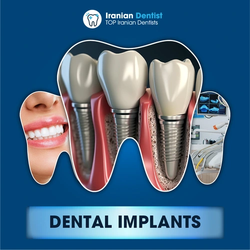 Iranian Dental Implants Clinic and Dentist in Australia