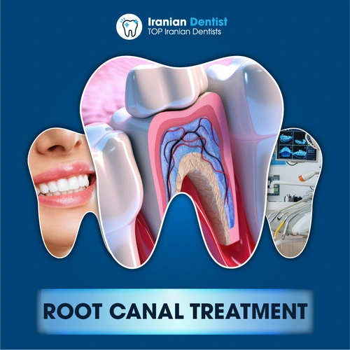 Iranian Root Canal Treatment Dentist in Australia