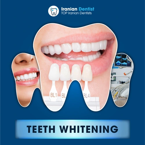 Iranian Teeth Whitening Clinic in Australia