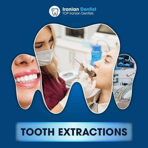 Iranian Tooth Extractions Clinic and Dentist in Australia
